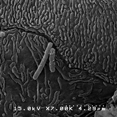 SEM of bacteria on epithelial cell