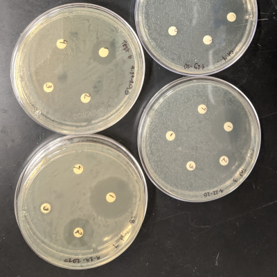 microbial inhibition zones